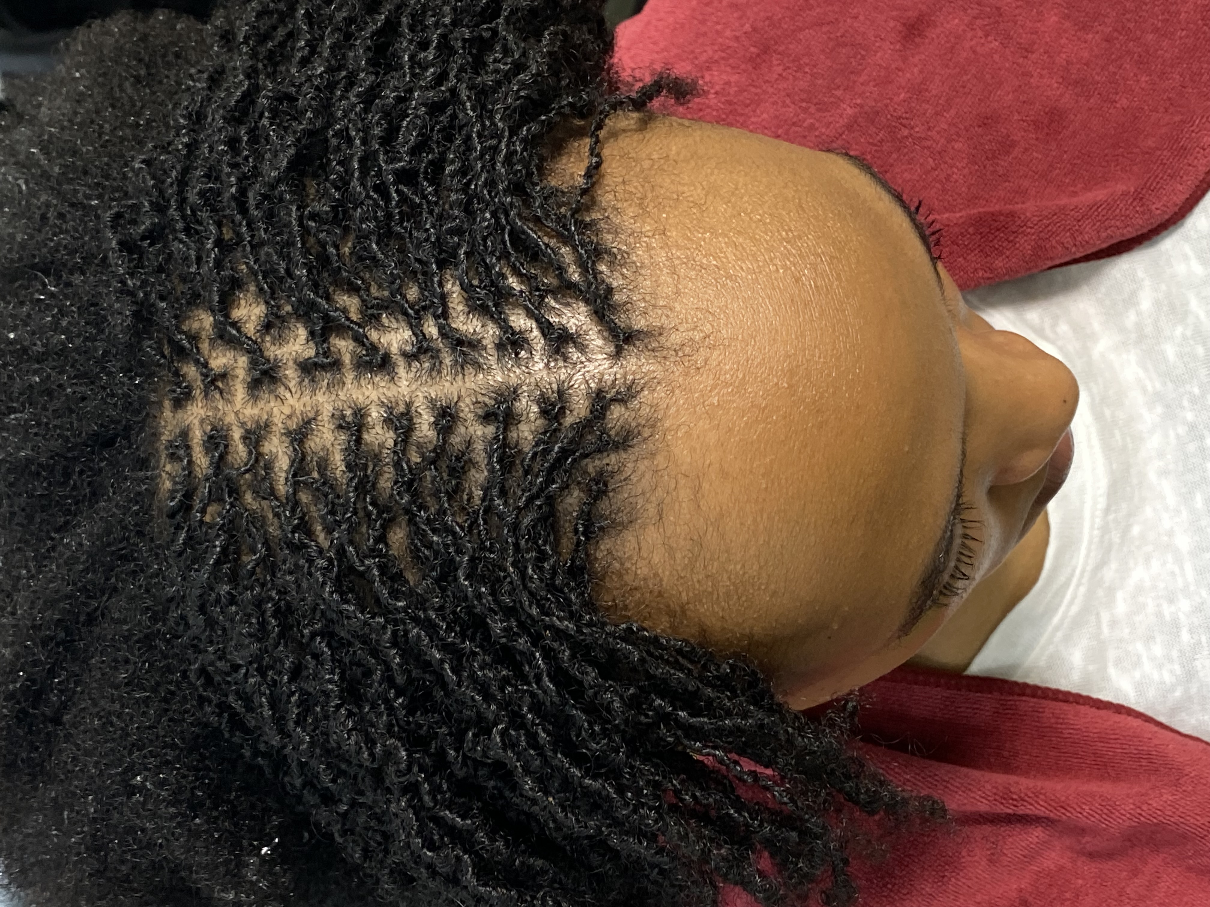 How to Start Microlocks: Installation Methods and the Right Foundation