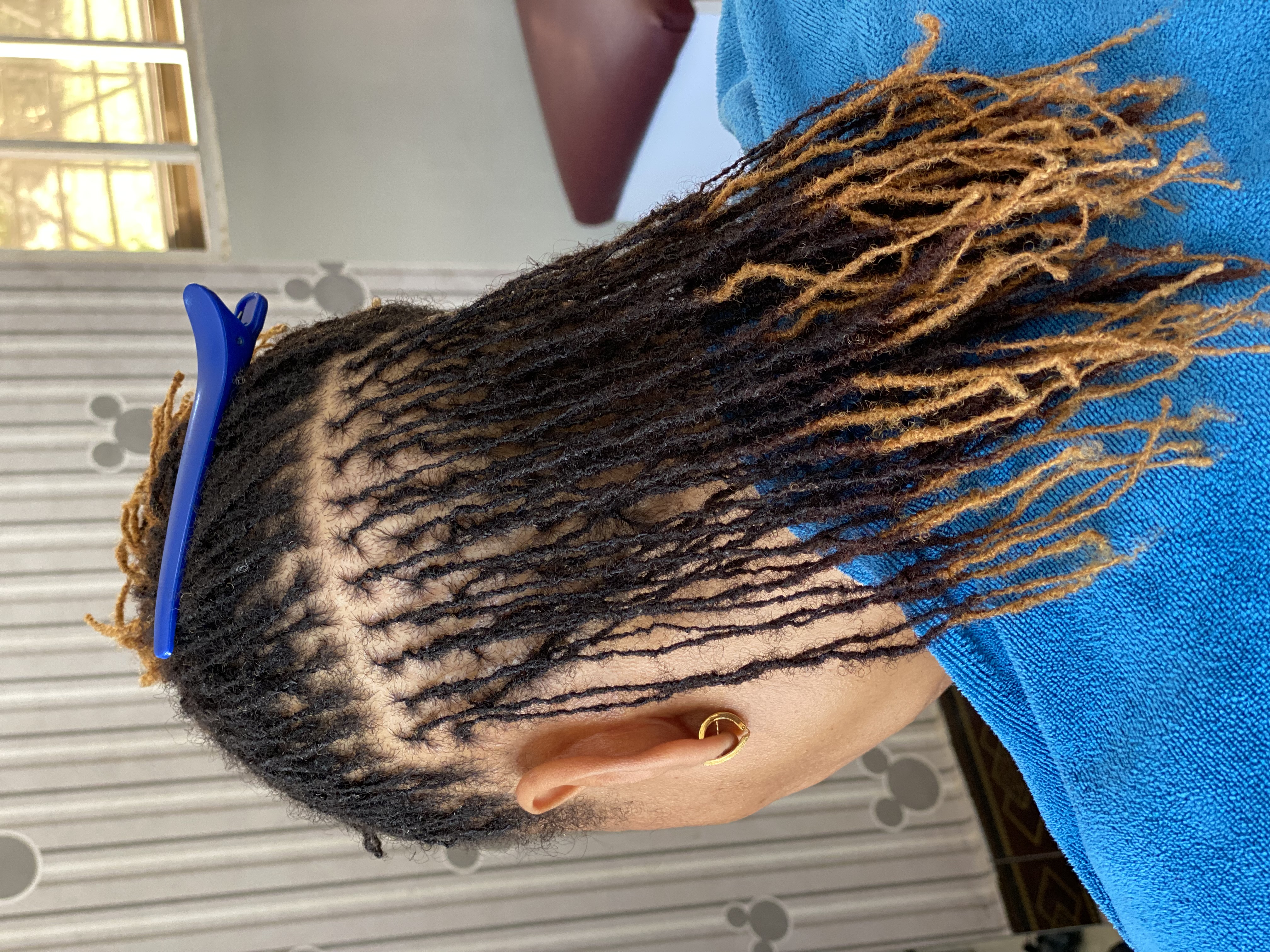 Microlocks Maintenance: It’s More Than Retightening the Roots